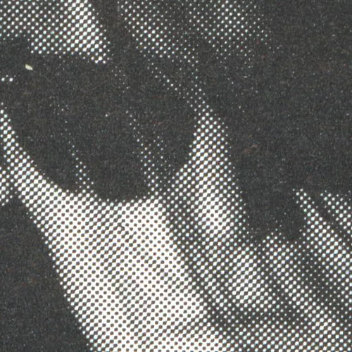 X-Ray Eyes