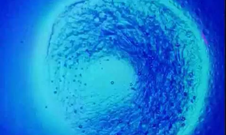 Fracture (Official Video)