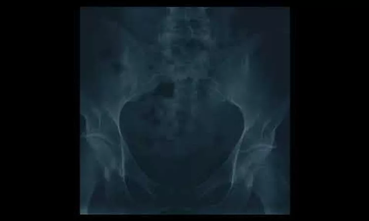 Will Kuiper - Diffusion