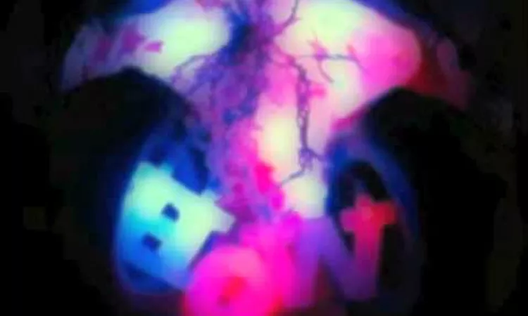 Piero Umiliani Synthi Grotesque
