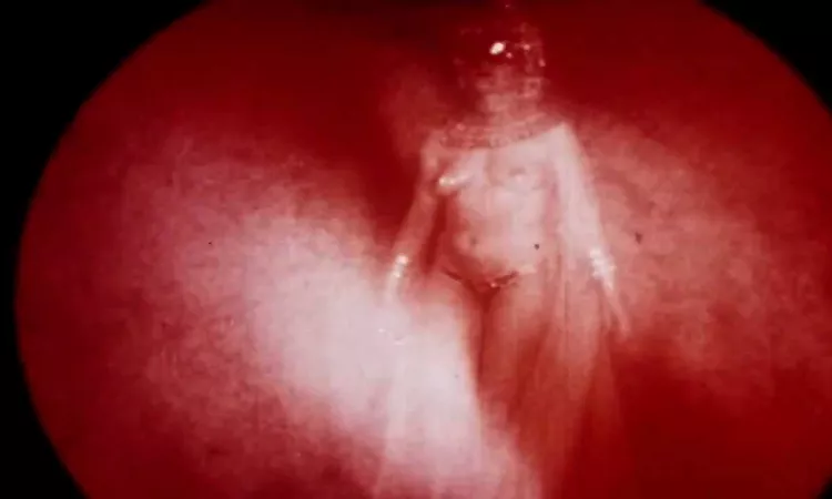 Broadcast and the Focus Group - The Be Colony